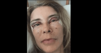 Blog: The Dangers of Lookmaxxing 4 image 11