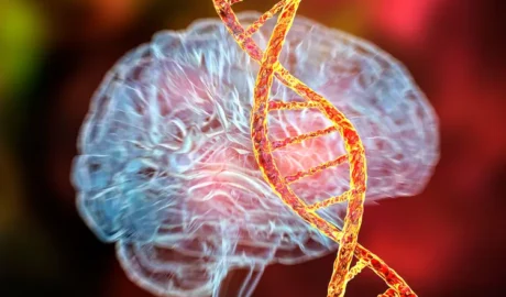 huntington disease huntington's disease treatment